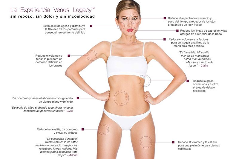 Ventajas Venus Legacy