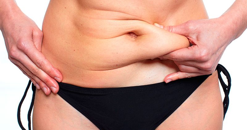 abdominosplatia-ventajas