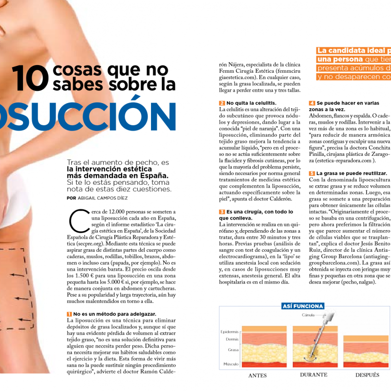liposuccion-conchita-pinilla